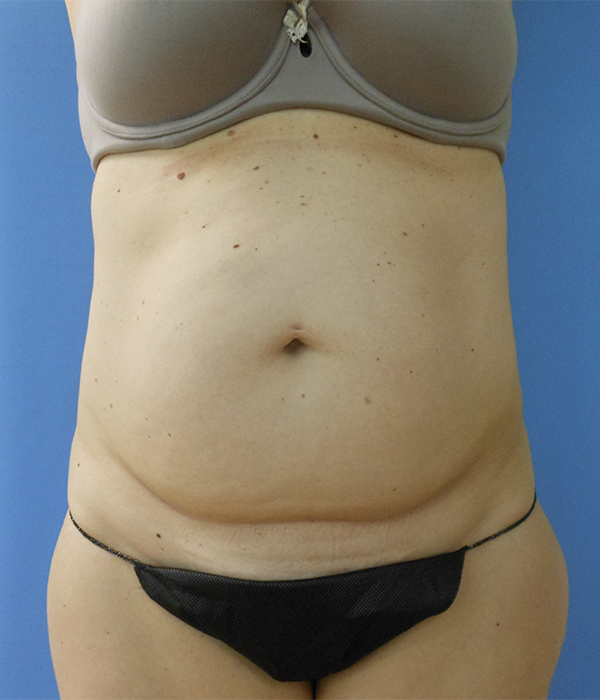 Image of a person's midsection, wearing a gray bra and black underwear, against a blue background