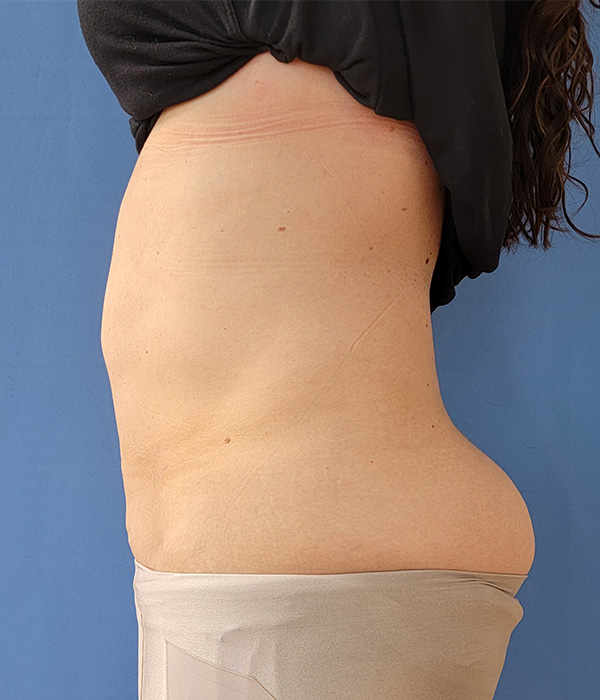 Side view of a person with visible skin texture and a smooth torso against a blue background