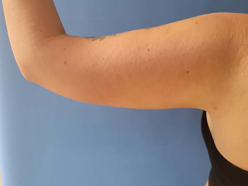 Close-up of a person's bare arm against a blue background