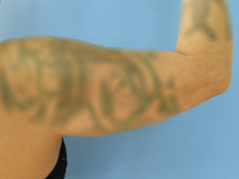 A blurred image of a tattooed arm against a light blue background