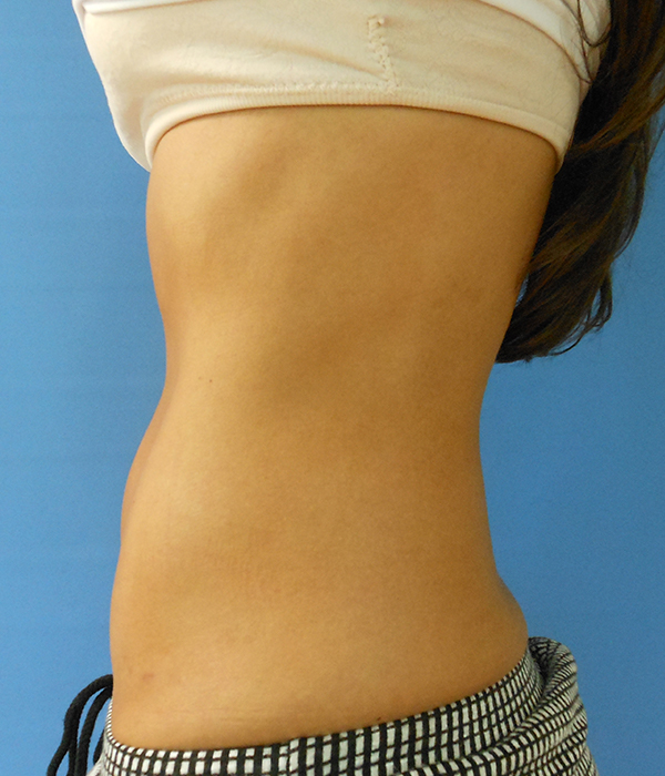 Side view of a person's bare midsection against a blue background