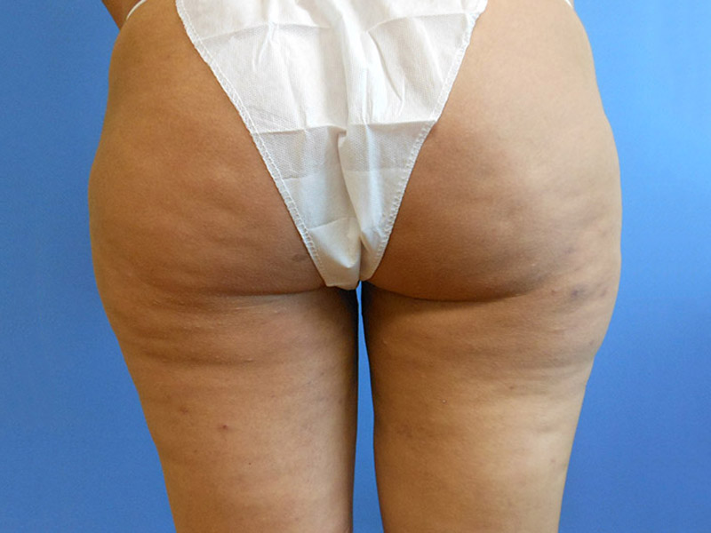 Rear view of a person's lower body wearing a white thong against a blue background