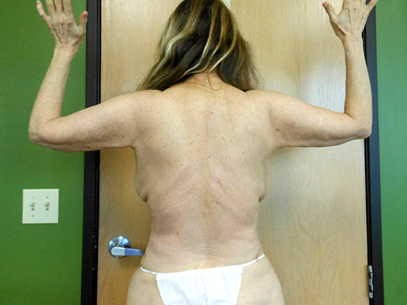 A woman is seen from behind with her arms raised, wearing minimal clothing