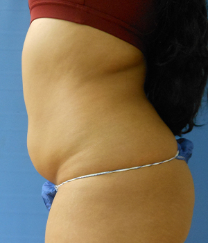 Profile view of a person's torso, wearing a red top and blue bottoms