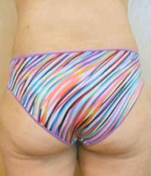 Person's back view wearing colorful striped swimwear