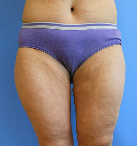 Person standing, wearing purple underwear against a light blue background