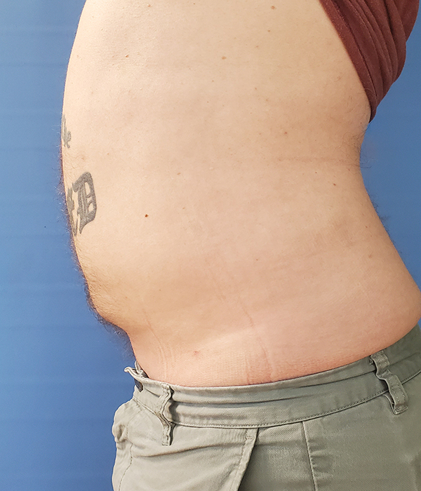 Side view of a person's torso, showing a bare abdomen and a tattoo
