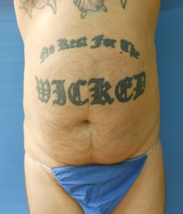 A man's torso displays tattoos and he is wearing blue swim briefs