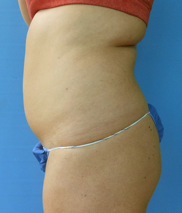 Profile view of a person with a rounded abdomen wearing a top and a blue bottom