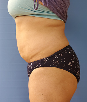 Side view of a person wearing a light top and dark patterned underwear, against a blue background