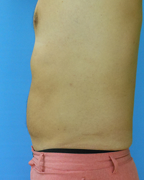 Man's bare torso shown from the side against a blue background