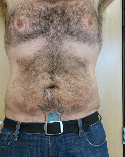 Upper body of a person with body hair and a tattoo on the stomach, wearing jeans and a belt