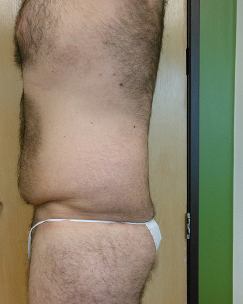 Side view of a person with a hairy torso wearing white underwear, standing beside a door