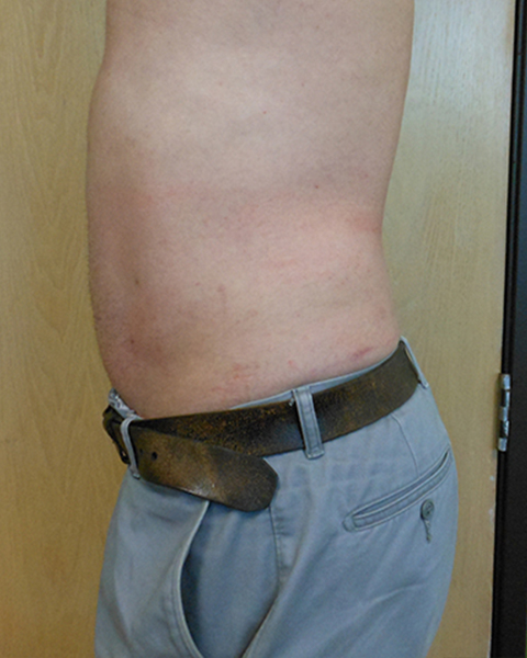 Side view of a man’s torso showing bare skin and a belt. Background is a plain wall