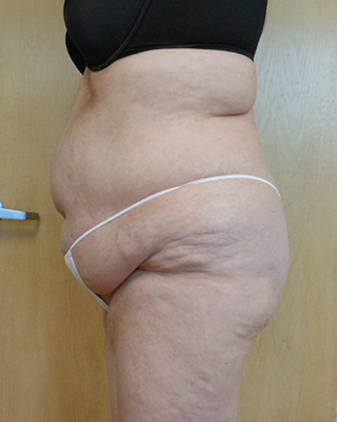 Side view of a person with visible skin texture and body curvature, wearing minimal clothing