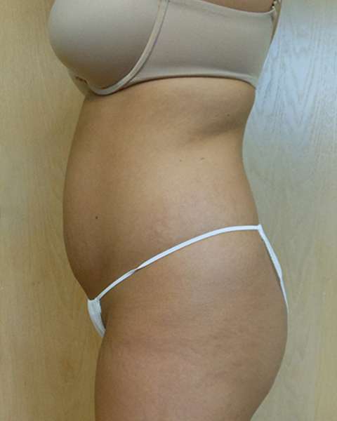 Side view of a person in a brassiere and thong underwear, showing their abdomen