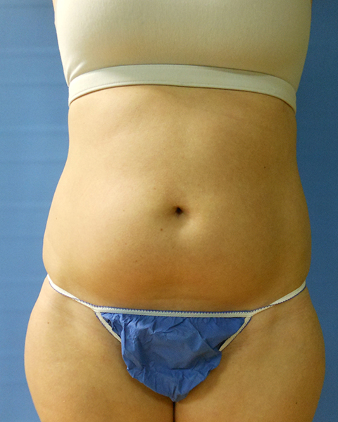 Person's abdomen wearing a beige top and blue garment. Background is blue
