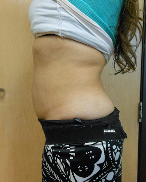 Side view of a person's midsection, wearing a cropped top and patterned bottom