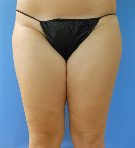 Front view of a person wearing black underwear against a blue background