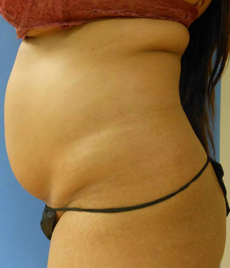 Side view of a person with a prominent belly and wearing black underwear