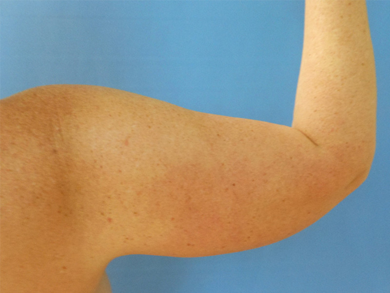 Close-up of a human arm raised against a blue background