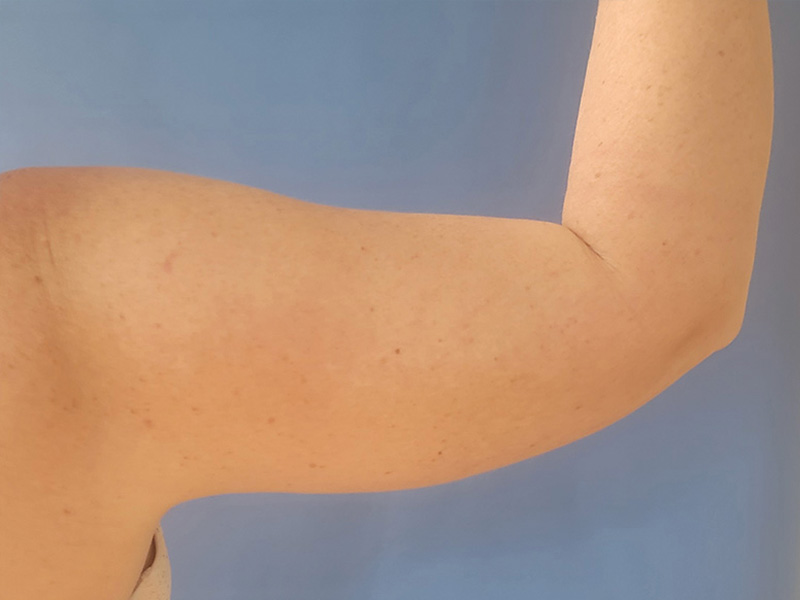 A close-up of a bent human arm against a blue background