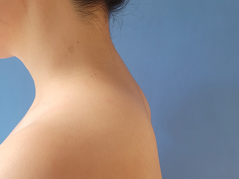 Side profile of a person’s neck and shoulder against a blue background