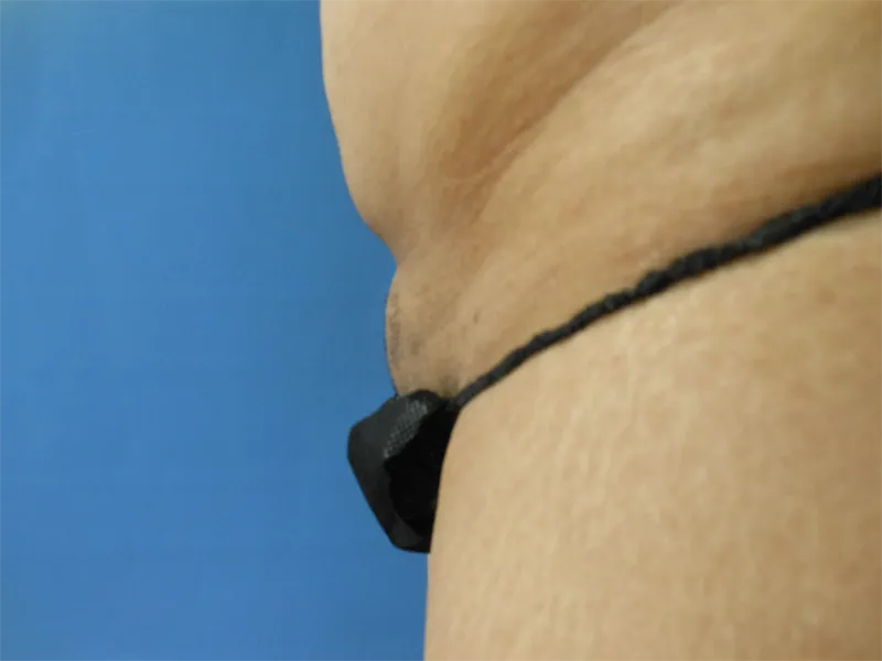 Close-up of a body with a black cord and small attachment against a blue background