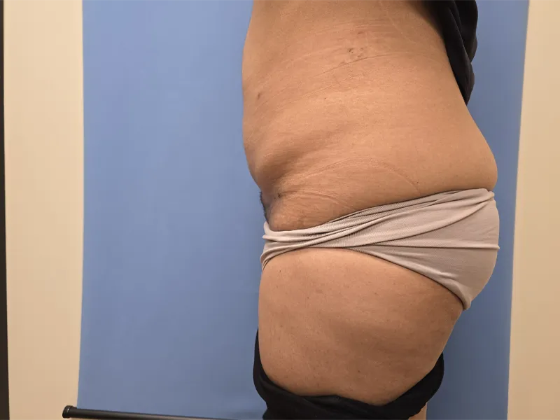 Side view of a torso with a person wearing gray underwear against a blue background