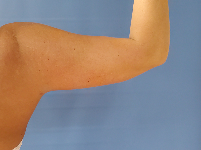 A close-up of a person's raised right arm against a blue background