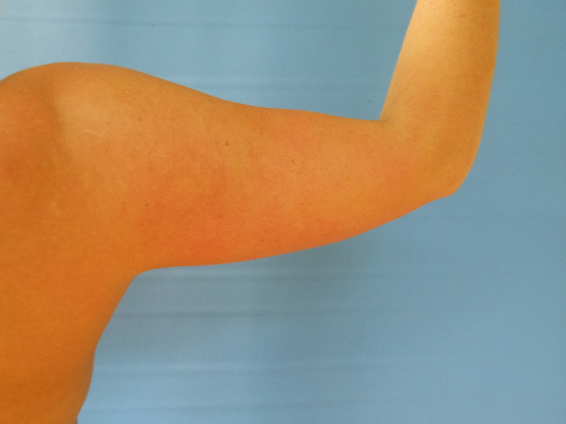 A close-up of a partially raised arm against a blue background
