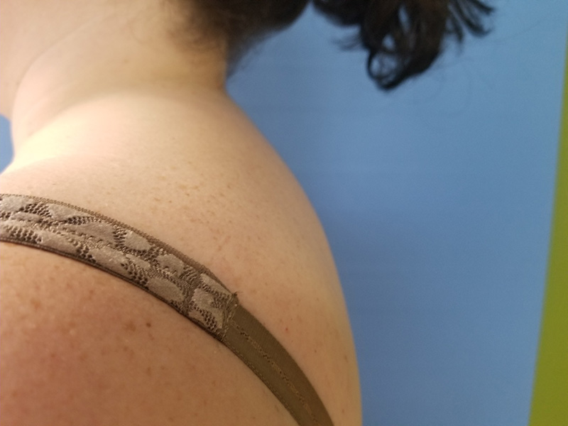 Close-up of a shoulder with a patterned strap against a blue background