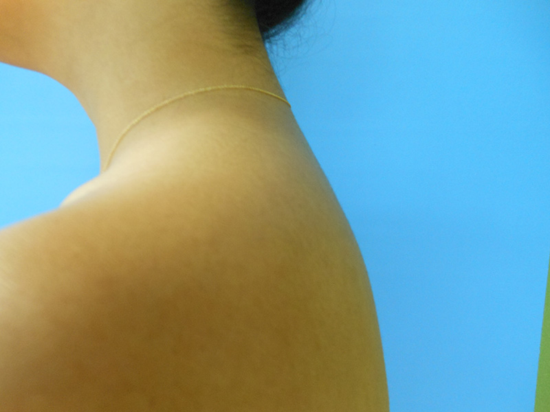 Close-up of a bare shoulder and neck against a blue background