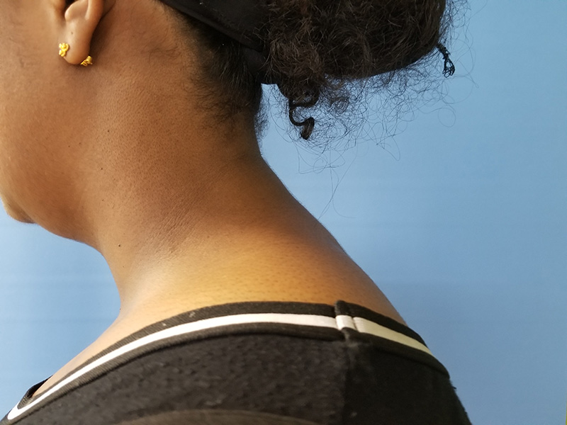 Side view of a person’s neck and shoulder against a blue background
