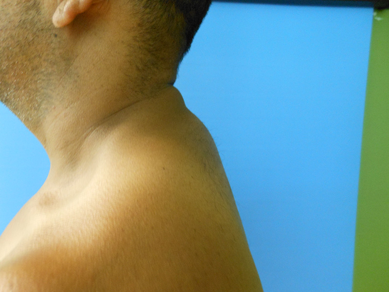 Person's shoulder and neck are visible against a blue background