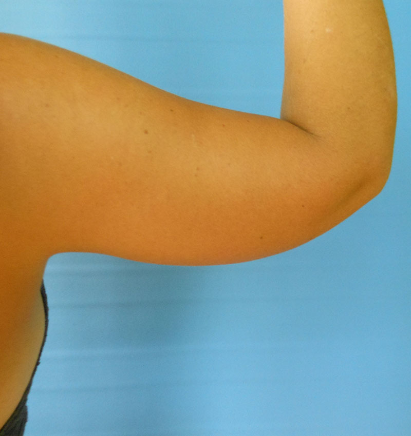 A close-up of a tan arm raised against a light blue background