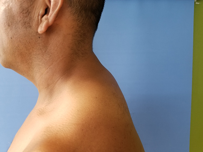Side profile of a man's neck and shoulder against a blue and green background