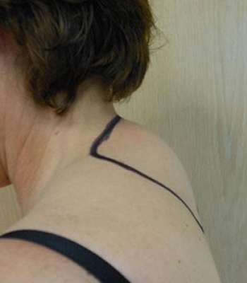 A close-up of a woman's back with a black line drawn along her shoulder