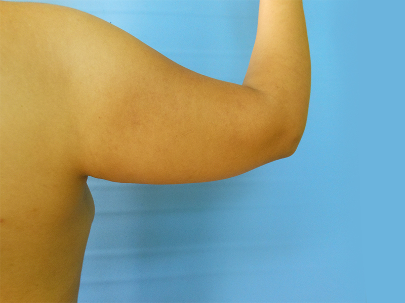Close-up of a bare arm raised against a blue background