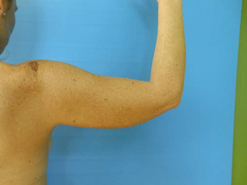 A bare arm is raised against a blue background