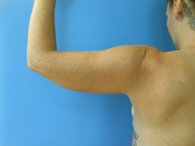 Close-up of a bare shoulder and arm against a blue background