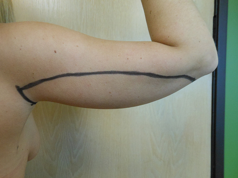 An arm is raised with a black line drawn along the bicep area against a wooden surface