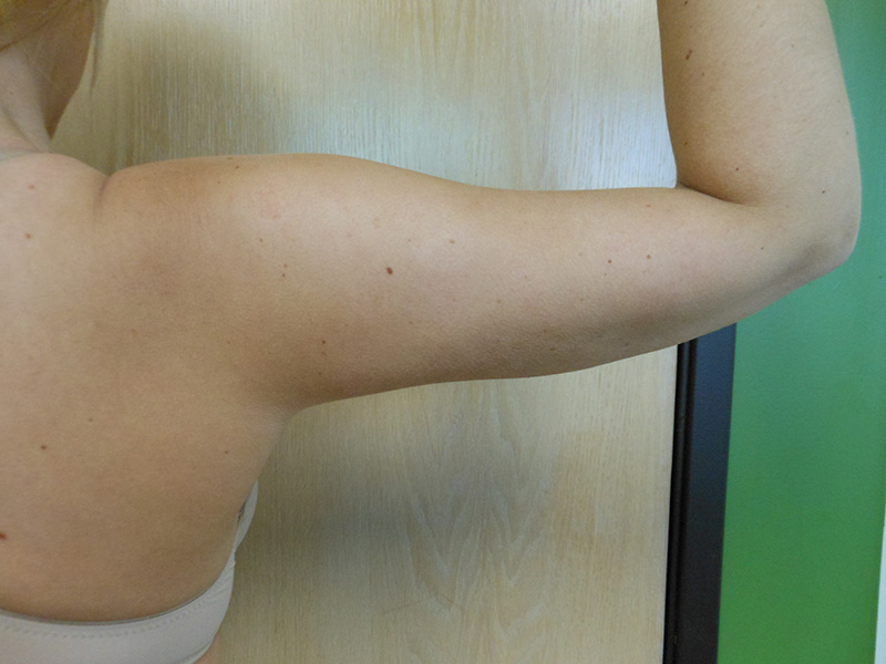 A close-up of a woman's bare arm against a wooden background