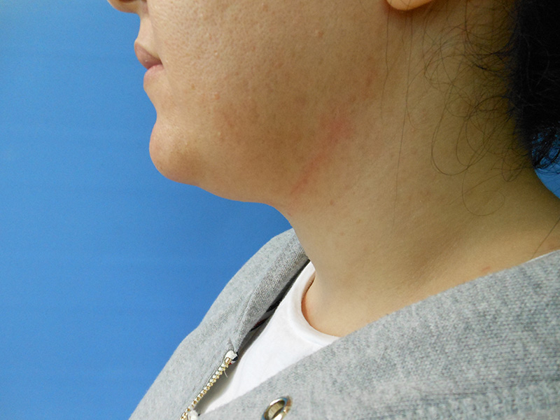Side profile of a person with light skin and brown hair against a blue background