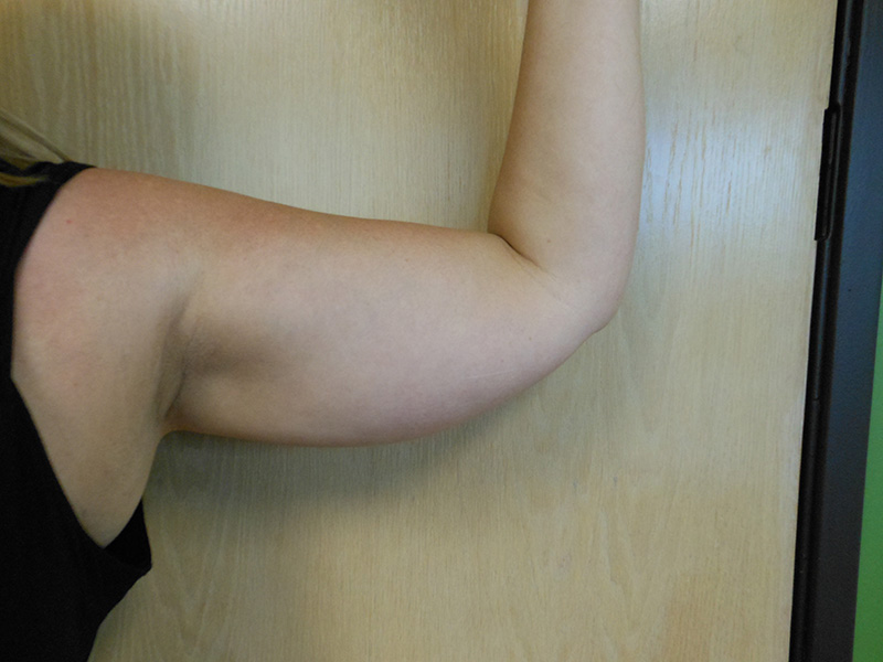 A close-up of a person's raised arm against a wooden background