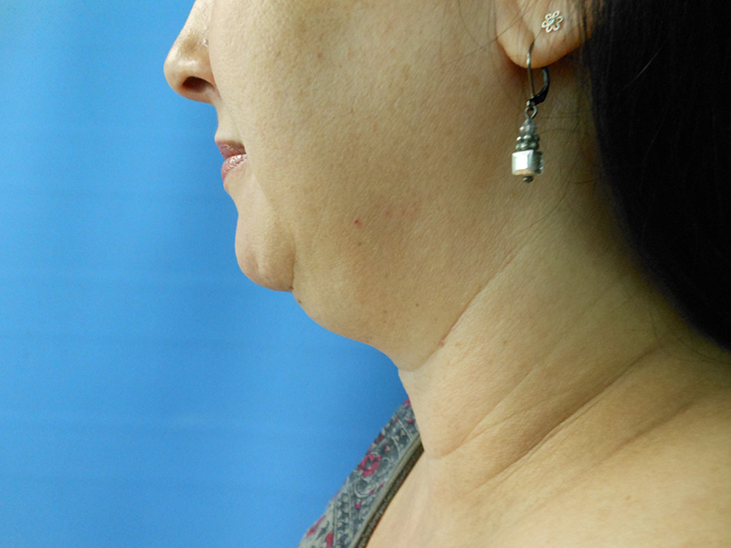 Profile view of a woman with long dark hair and an earring against a blue background