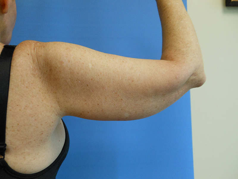 A close-up of a bare arm flexing against a blue background