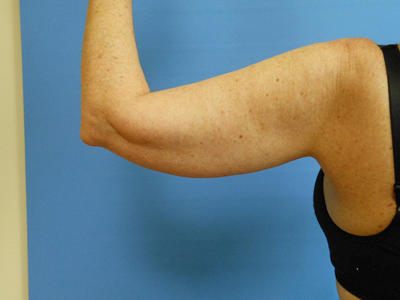 A close-up of a woman's arm flexed at the elbow against a blue background