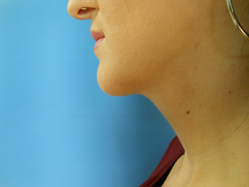 Profile view of a person with hoop earrings against a blue background