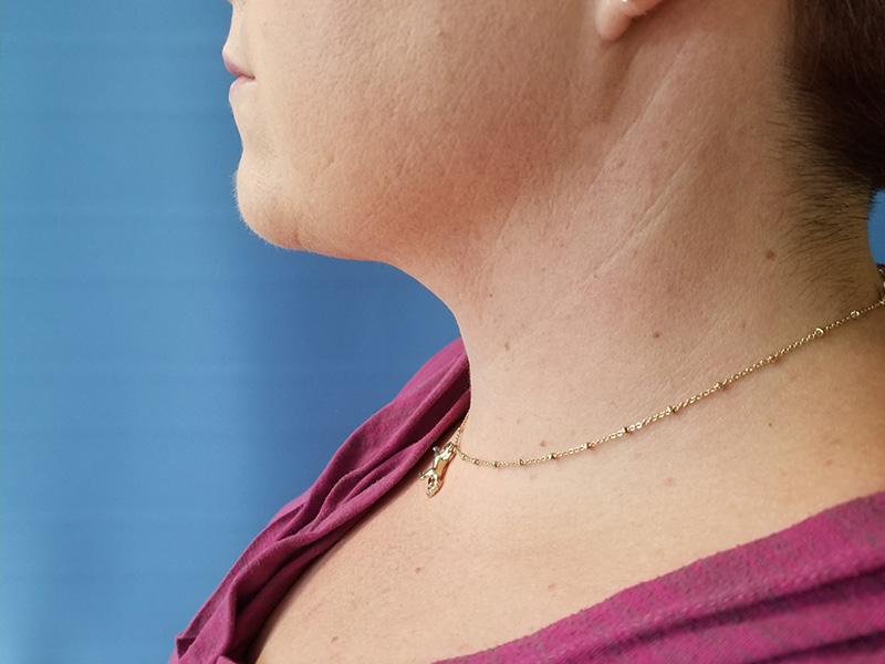 Profile view of a woman wearing a necklace, with a blue background